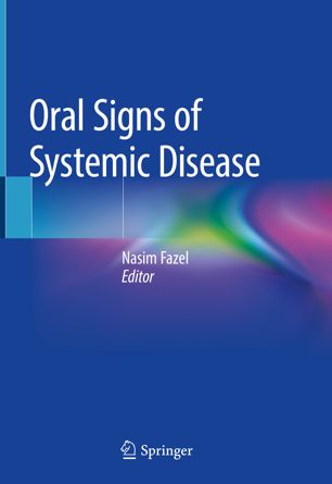 Oral signs of systemic disease