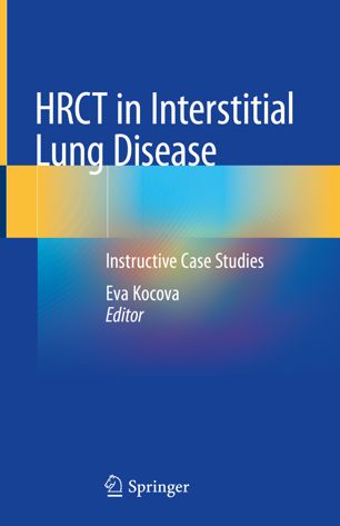 HRCT in interstitial lung disease : instructive case studies