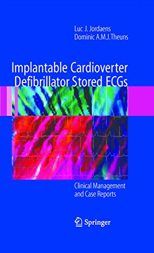 Implantable Cardioverter Defibrillator Stored ECGs: Clinical Management and Case Reports