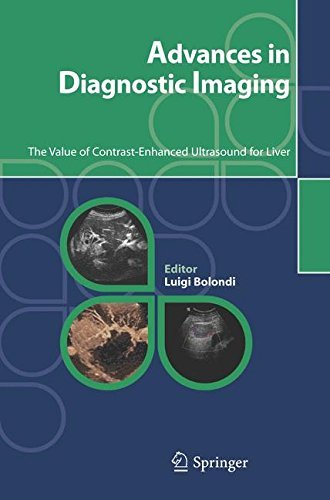 Advances in Diagnostic Imaging: The Value of Contrast-Enhanced Ultrasound for Liver