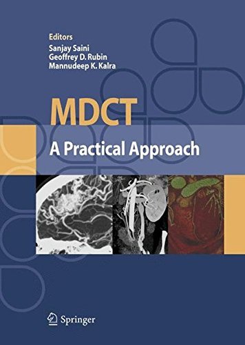 MDCT: A Practical Approach