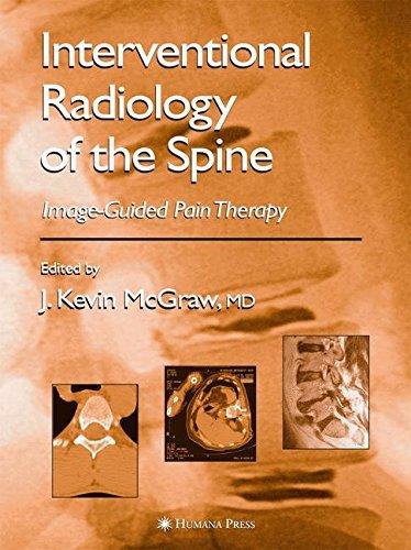 Interventional Radiology of the Spine: Image-Guided Pain Therapy