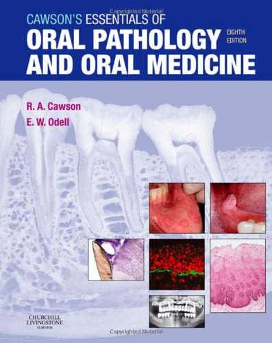 Cawson's Essentials of Oral Pathology and Oral Medicine