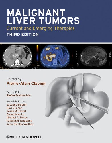 Malignant Liver Tumors: Current and Emerging Therapies