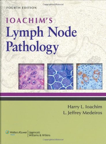 Ioachim's Lymph Node Pathology