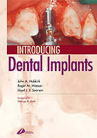 Introducing dental implants