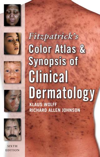 Fitzpatrick's Color Atlas and Synopsis of Clinical Dermatology