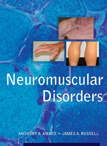 Neuromuscular Disorders