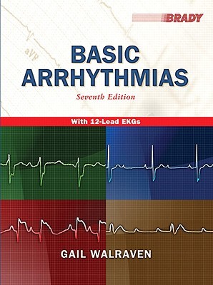 Basic Arrhythmias