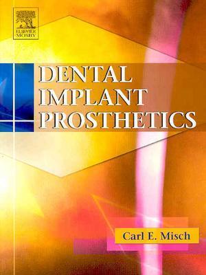 Dental Implant Prosthetics