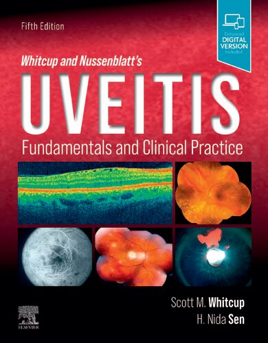 Whitcup and Nussenblatt's Uveitis