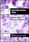 Varicella-zoster Virus