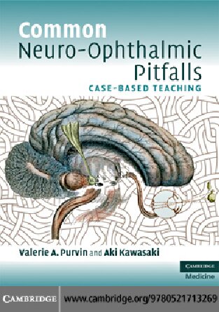 Common Neuro-Ophthalmic Pitfalls