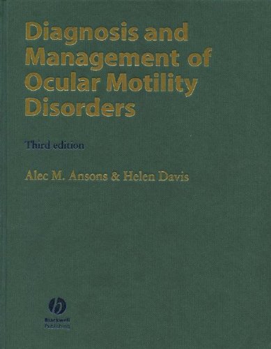 Diagnosis and Management of Ocular Motility Disorders