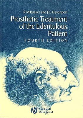 Prosthetic Treatment of the Edentulous Patient