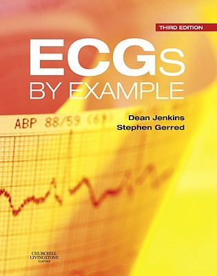 Ecgs by Example