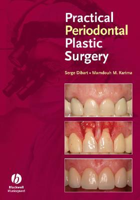 Periodontal Plastic Surgery