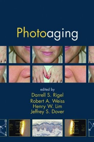 Photoaging