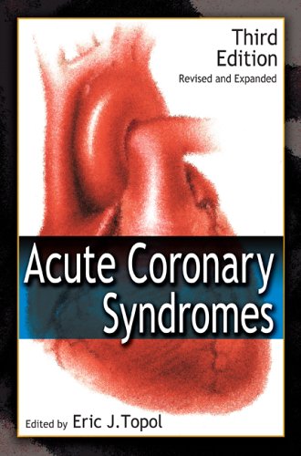 Acute Coronary Syndromes