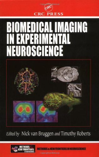 Biomedical Imaging in Experimental Neuroscience