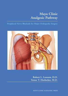 Mayo Clinic Analgesic Pathway