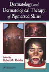 Dermatology and Dermatological Therapy of Pigmented Skins