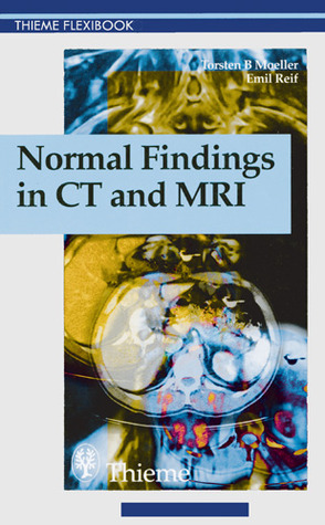 Normal Findings in CT and MRI