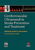 Cerebrovascular ultrasound in stroke prevention and treatment