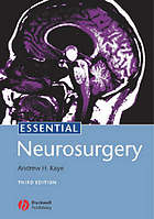 Essential neurosurgery