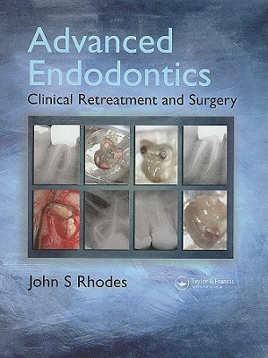 Advanced Endodontics