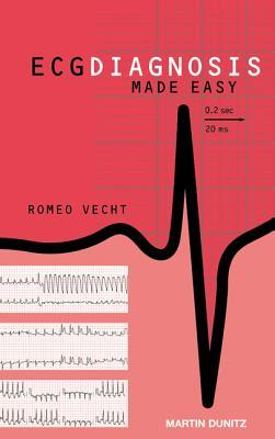 ECG Diagnosis Made Easy [With CDROM]