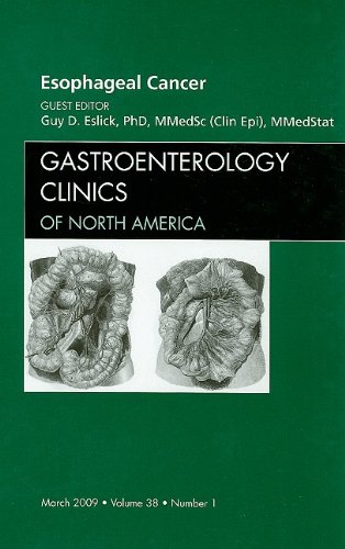 Esophageal Cancer, an Issue of Gastroenterology Clinics, 38