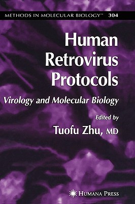 Human Retrovirus Protocols