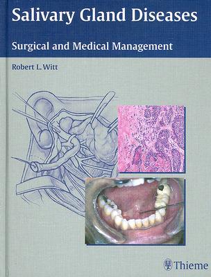 Salivary Gland Diseases