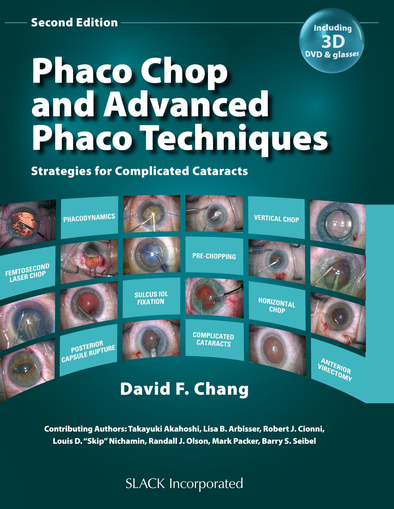 Phaco Chop and Advanced Phaco Techniques