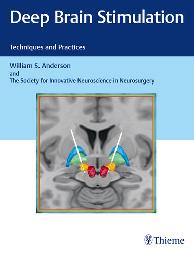 Deep brain stimulation : techniques and practices