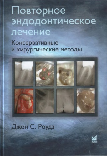 Advanced Endodontics
