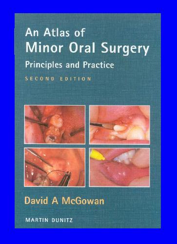 An Atlas of Minor Oral Surgery