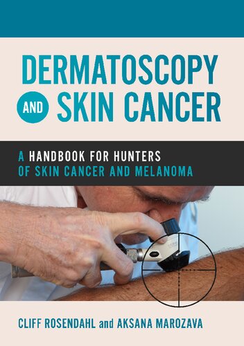 Dermatoscopy and Skin Cancer