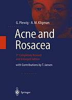 Acne and rosacea