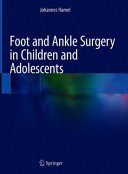 Foot and ankle surgery in children and adolescents