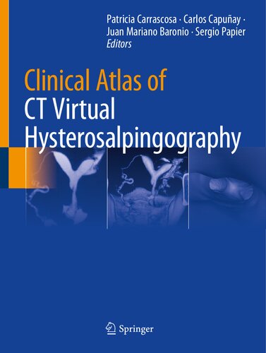 Clinical atlas of CT virtual hysterosalpingography