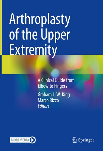 ARTHROPLASTY OF THE UPPER EXTREMITY : a clinical guide from elbow to fingers.