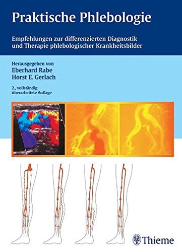 Praktische Phlebologie Empfehlungen zur differenzierten Diagnostik und Therapie phlebologischer Krankheitsbilder ; 69 Tabellen