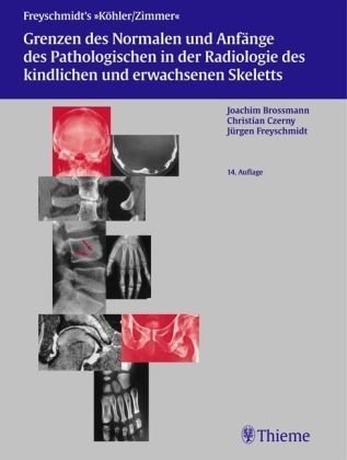 Freyschmidt's "Köhler/Zimmer" Grenzen des Normalen und Anfänge des Pathologischen in der Radiologie des kindlichen und erwachsenen Skeletts.