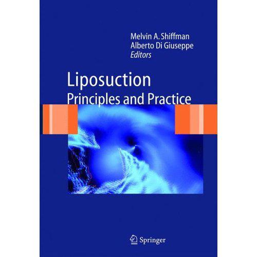 Liposuction