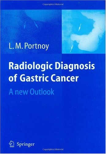 Radiologic Diagnosis Of Gastric Cancer