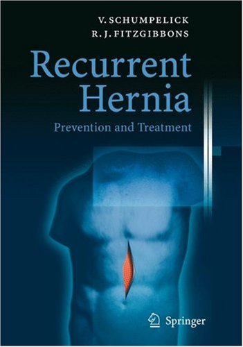 Recurrent Hernia