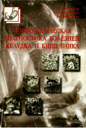 Morfologicheskai︠a︡ diagnostika bolezneĭ zheludka i kishechnika