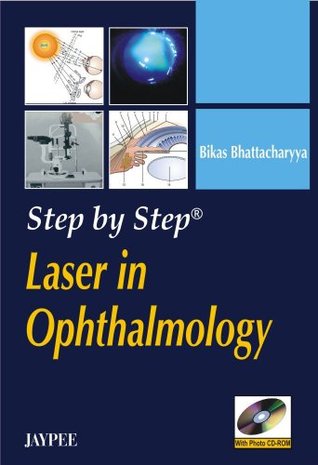 Step by Step Laser in Ophthalmology with Photo CD-ROM